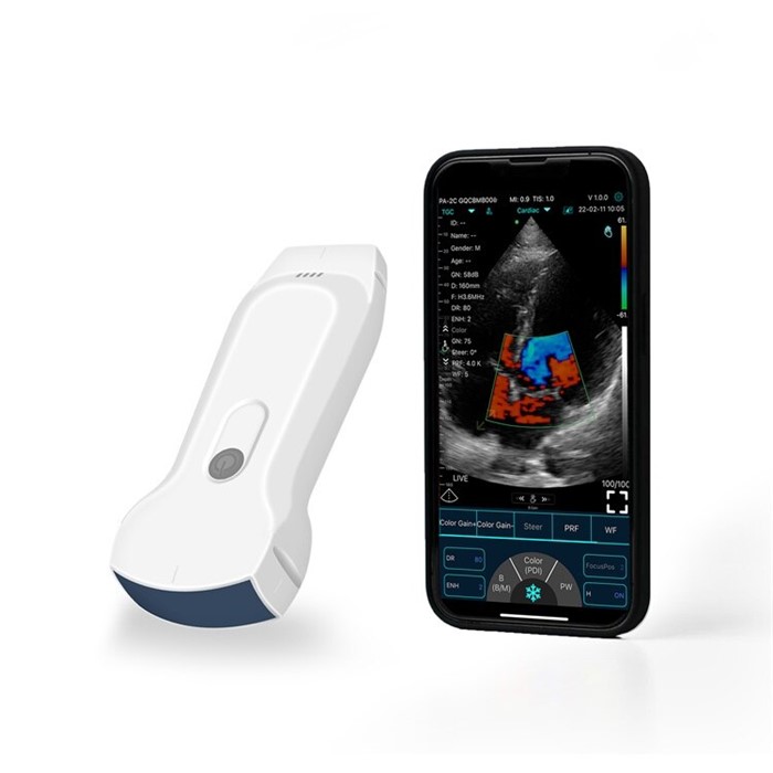 Handheld Ultrasound Machine